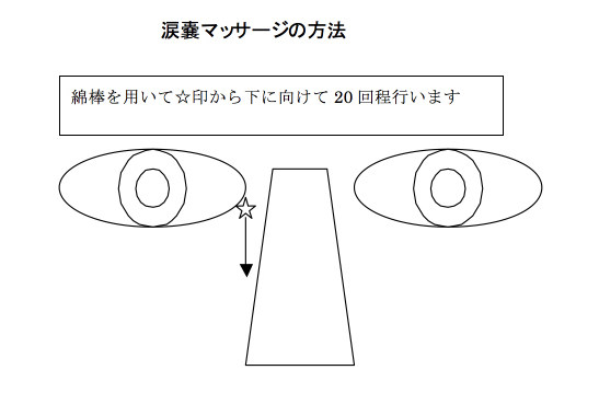 先天性鼻涙管閉塞症